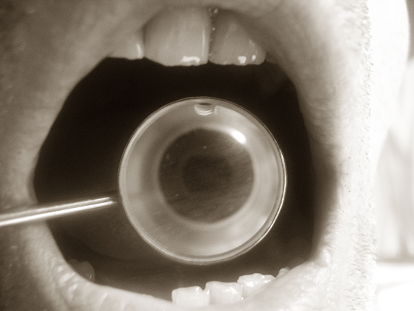 Krzysztof Fijalkowski, Mouth Mirror